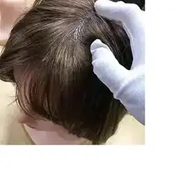 Implanted Synthetic Hair